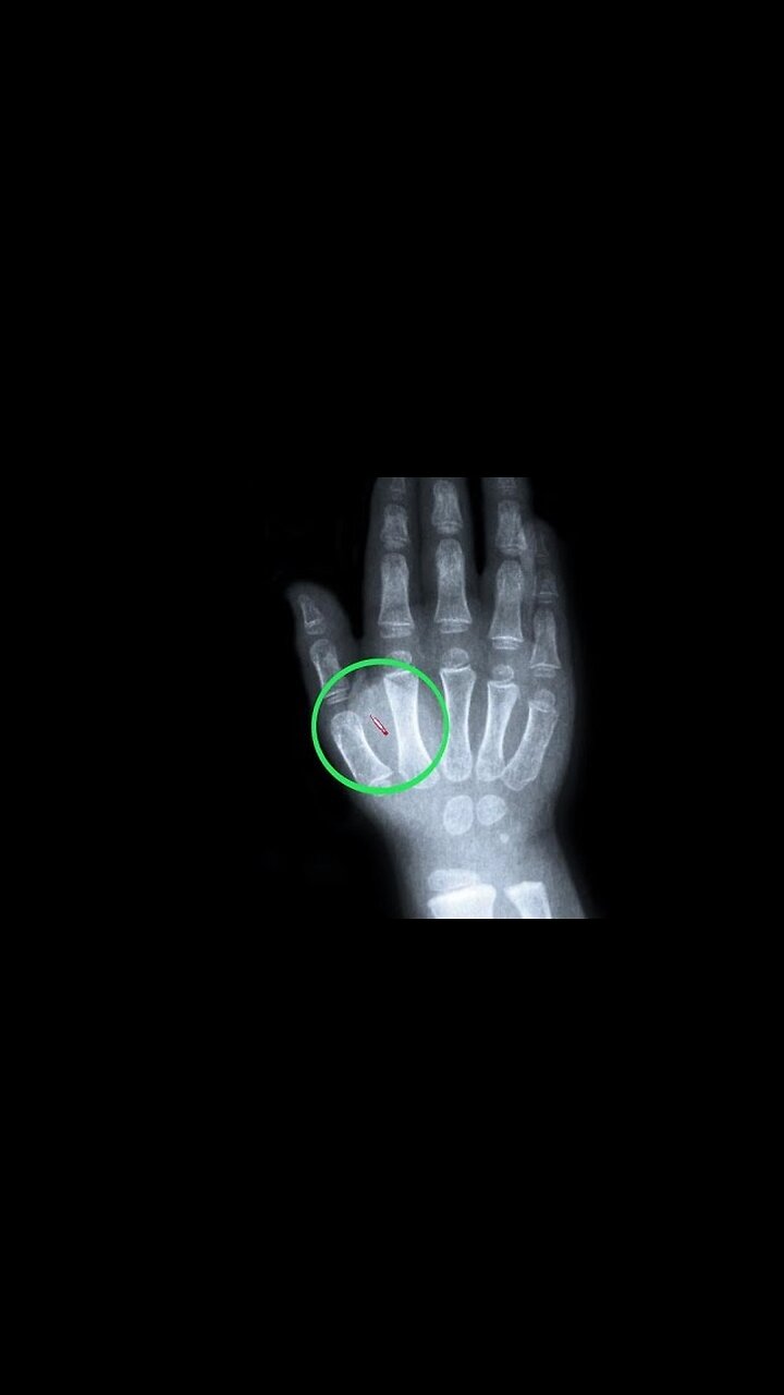 Rfid Tracking Technology Breeding Farms Sex Slavery In America