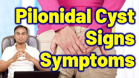 Signs and Symptoms of Pilonidal Cyst Sinus Abscesses | Treatment Cure Medicine Surgery Dr. Bharadwaz