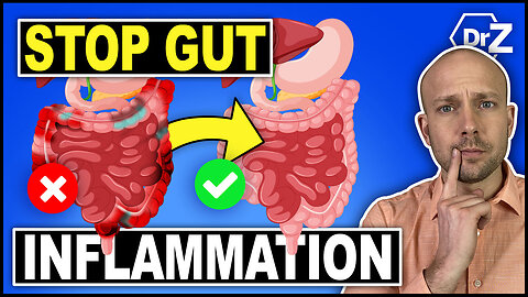 How To Reduce Gut Inflammation - Doctor Reveals