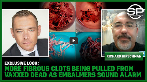 EXCLUSIVE LOOK: MORE Fibrous Clots Being Pulled From Vaxxed DEAD As Embalmers Sound Alarm