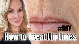 How to Treat Lip Lines - What Works & What Doesn't