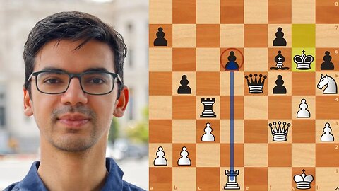 Anish Giri Did The Impossible!