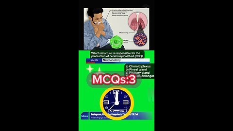 Neurological mcqs #mcqs #medicine #doctors #nurses