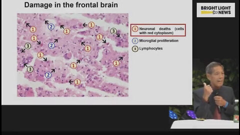 Spike Protein damages the Brain