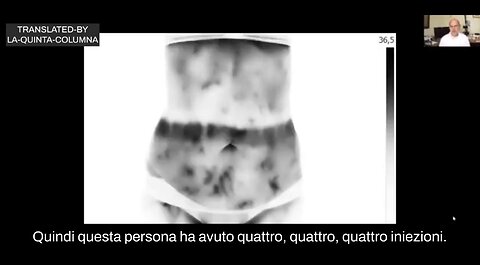 NWO, VACCINI: Termografia di vaccinati, Dottor Reitz Felipe, Effetti Avversi