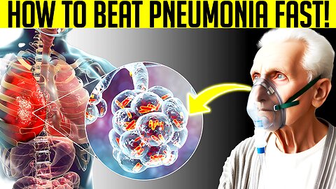 Pneumonia Explained Causes, Symptoms, Diagnosis & Treatment Options 💡