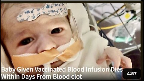 Baby Given Vaccinated Blood Infusion Dies Within Days From Blood clot