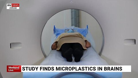 Study on microplastics reveal their shocking impact on the human brain