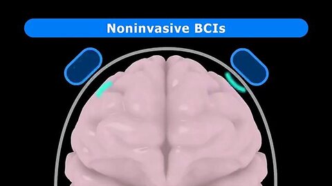 CYBORGS, SYNTHETIC BIOLOGY AND GROWING YOUR BIOLOGICAL BRAIN IMPLANT 😲