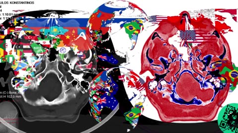 CT scan + Flag map + Flag globes + BCH address (10s*20fps*512p)