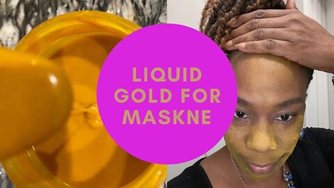 Maskne Support, Acne Relief with Liquid Gold