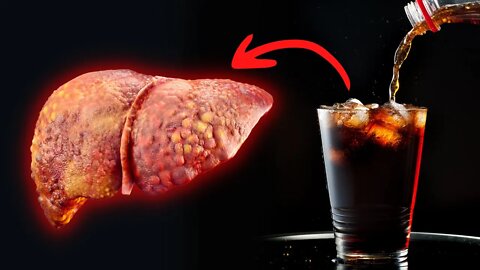 The Dark Side of Diet Soda That Nobody Talks About