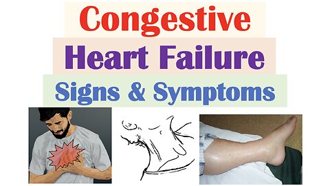 Congestive Heart Failure Signs & Symptoms (& Why They Occur)