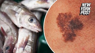 Eating fish could increase your risk of skin cancer, study says