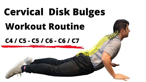 Workout routine for Cervical Disc Bulges - Beginner Level