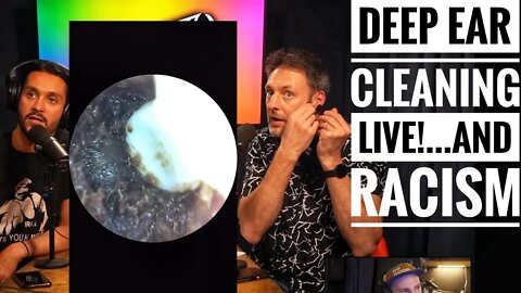 Deep Ear Cleaning LIVE!, Racism, and Feud of the Week - 3SP episode #41