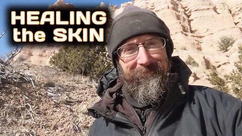 Healing the Skin