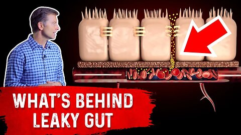 What's Really Behind Leaky Gut? – Dr.Berg On Leaky Gut Symptoms & Vitamin C Deficiency