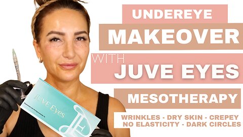 Juve Eyes Mesotherapy Treatment- CODE BEAUTYLAB10