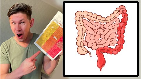 Ulcerative Colitis Treatment with German New Medicine