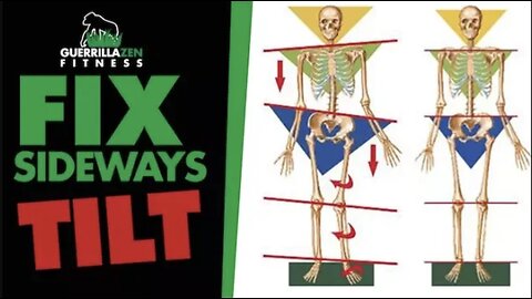 Uneven Hips aka Lateral Pelvic Tilt | Fix the ROOT cause!