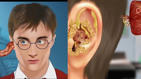 [ASMR ANIMATION] Help Harry Potter Brain ASMR SCP Foundation