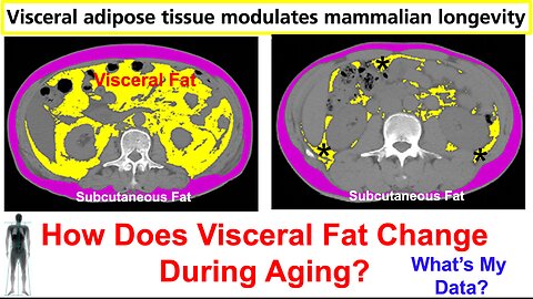 Visceral Fat Removal Extends Lifespan