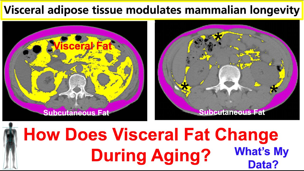 Visceral Fat Removal Extends Lifespan