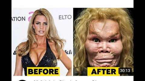 20 Celebrity Plastic Surgery Disasters