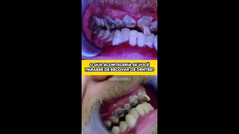 NÃO ESCOVAR OS DENTES DA NISSO!!! #escovar #dentes #sujeira #curiosidades #viralvideos