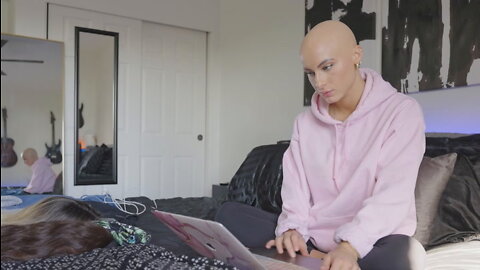 I Watched Myself Go Bald Three Times | BORN DIFFERENT