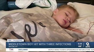 Middletown 2-year-old hospitalized with 3 viruses at once