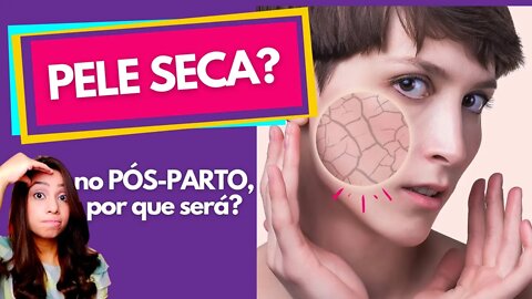 PELE SECA, RESSECADA, ESCAMANDO, NO PÓS-PARTO | POR QUE ESTOU ASSIM? Dicas para melhorar