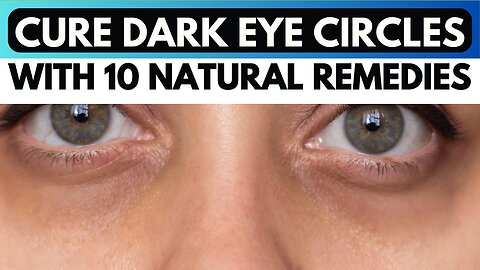 10 Natural Remedies To Cure Dark Eye Circles!