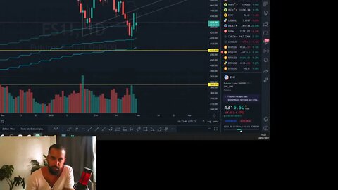 PAU QUEBRANDO E ATIVOS FINANCEIROS SE VALORIZANDO... ALGO DE ERRADO NÃO ESTÁ CERTO - 28/02/2022