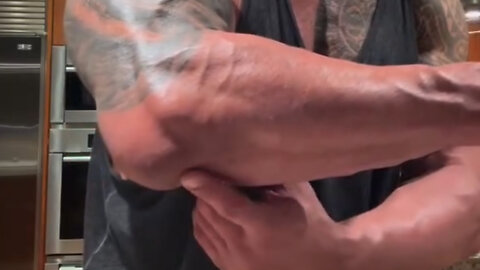 Dwayne "The Rock" Johnson with a nasty elbow injury