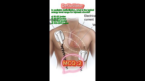 Defibrillator machine in icu #defibrillator #mcqs #pharmacologynotes #MedicalQuiz #mcqs #quiz