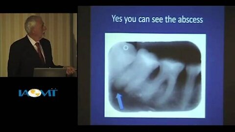 Thomas Colpitts N.D. discusses 3D Cat Scans in Dentistry at IAOMT 2010 Galloway