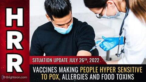 07-26-22 S.U. - Vaxx Making People HYPER Sensitive to POX allergies and FOOD TOXINS