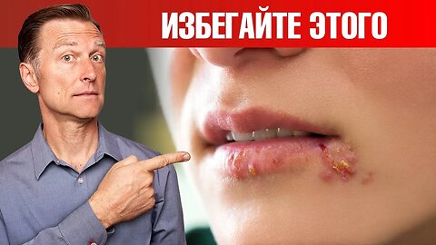 Избегайте этих продуктов, если у вас герпес! - ДокторБерг