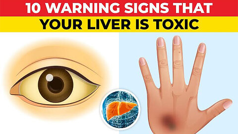 10 Warning Signs of a Toxic Liver