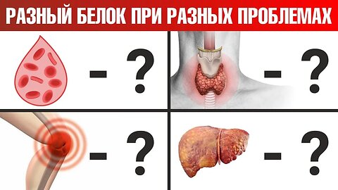 Какой вид белка нужен именно вам? Яйца? Мясо? Рыба? - ДокторБерг