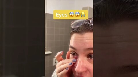 WTF ?!? Eyes pimple blackhead removal