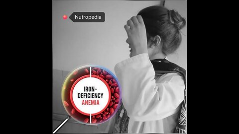 Iron Deficiency Anaemia