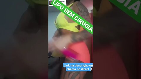 LIPO SEM CIRUGIA