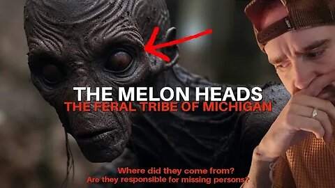 The Melon Heads: The Feral Tribe of Michigan