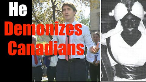 Turdeau Demonizes Non Vaxxers -- Proves Self Divise + UNFIT to Lead