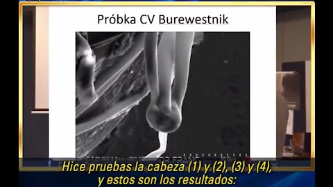 Franc Zalewski: Encontró una FORMA DE VIDA en la toma de Pfizer Comirnaty