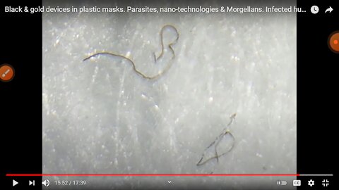 Black & gold devices in plastic masks. Parasites, Nano-technologies & Morgellans. Infected humanity!