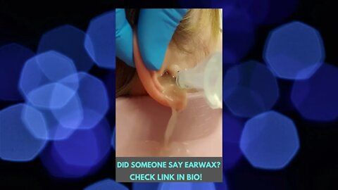 Ear Wax & Ear Wax Removal: That's Incredible! #Shorts #EarWax #EarWaxRemoval #Ear #Wow #Amazing